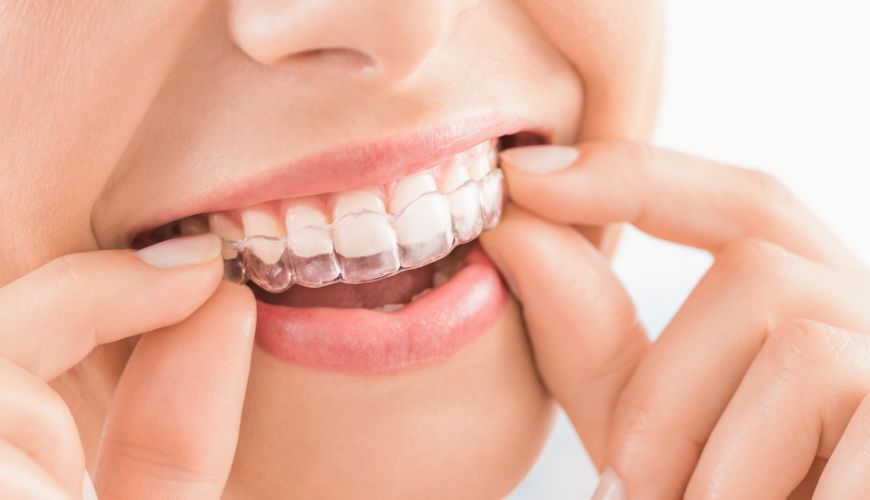 Invisalign Treatment In Chembur