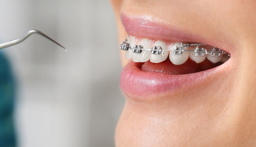 Orthodontics Treatment In Chembur